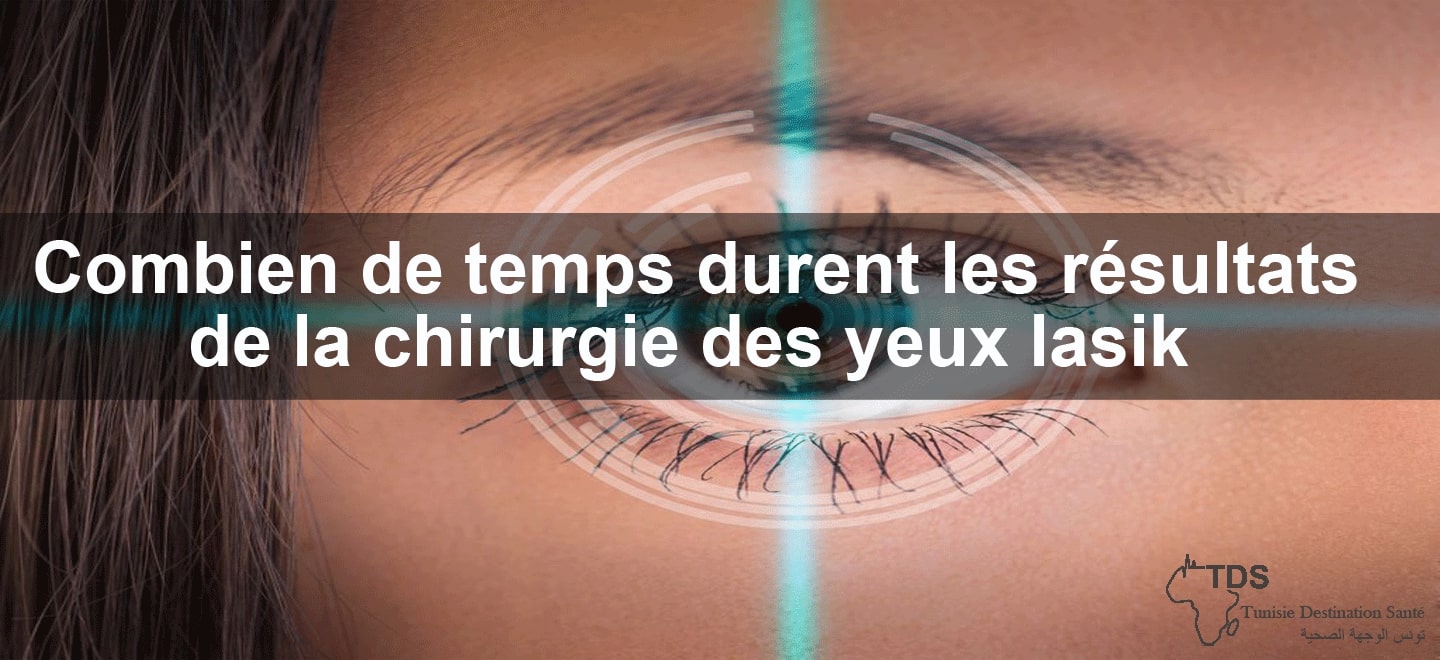 chirurgie yeux lasik