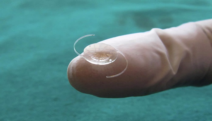 implant oculaire tunisie
