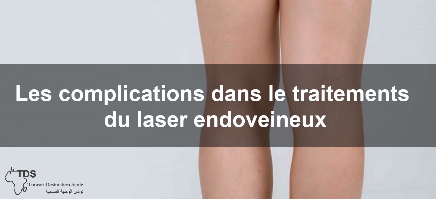 Les complications dans le traitements du laser endoveineux