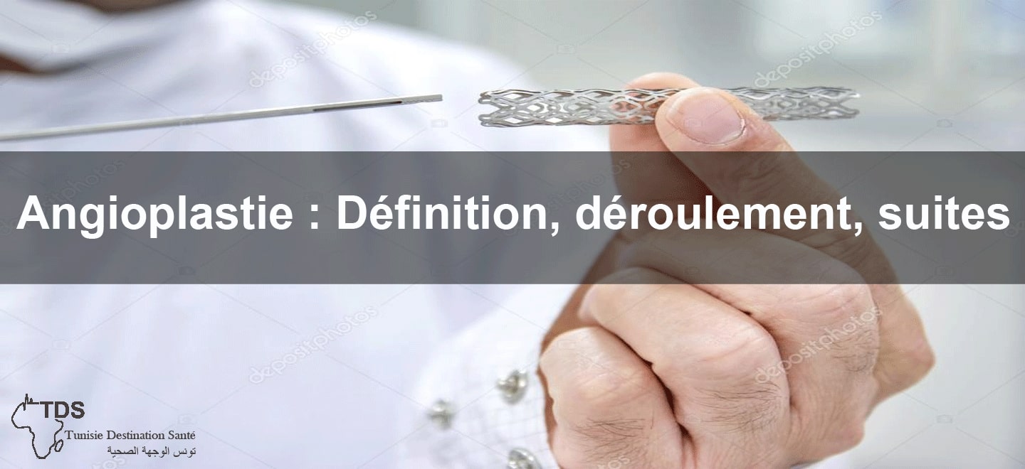 angioplastie deroulement