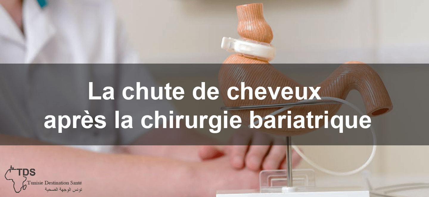 chute cheveux apres chirurgie bariatrique