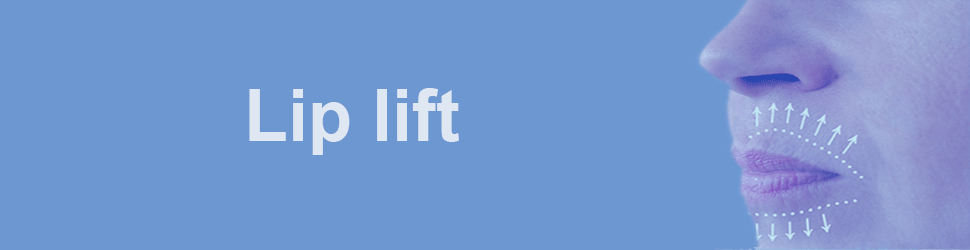 Lip-lift : lifting des lèvres