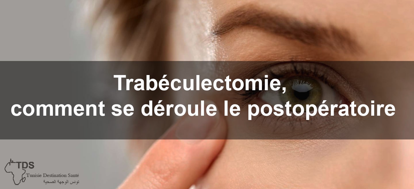 Trabeculectomie comment se deroule le postoperatoire