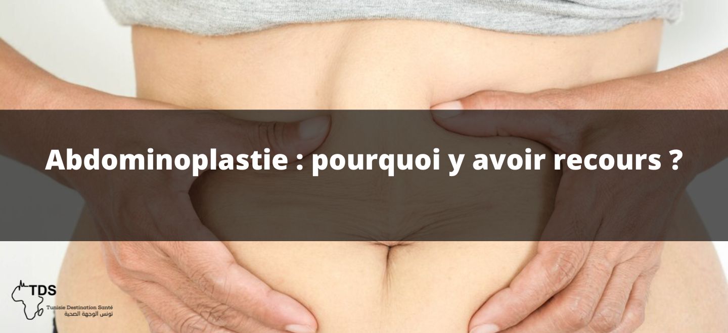 Abdominoplastie pourquoi y avoir recours