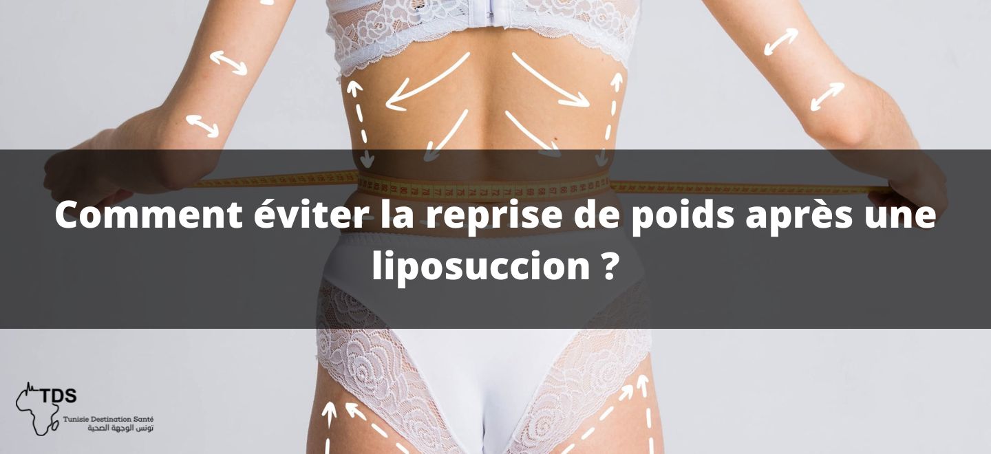 Comment éviter la reprise de poids après une liposuccion