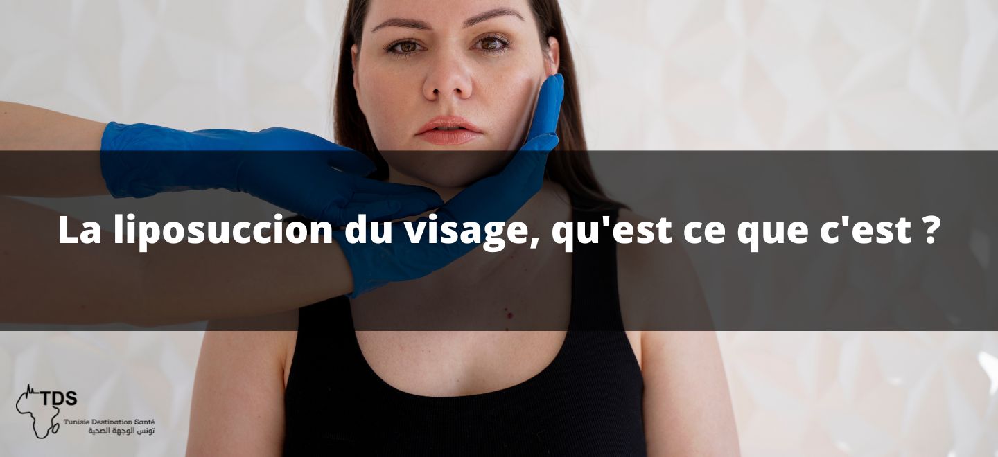 La liposuccion du visage, qu'est ce que c'est