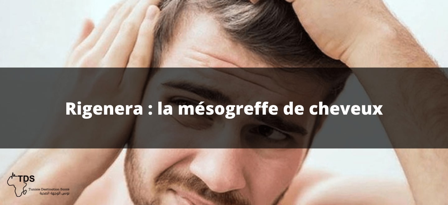 Rigenera la mesogreffe de cheveux