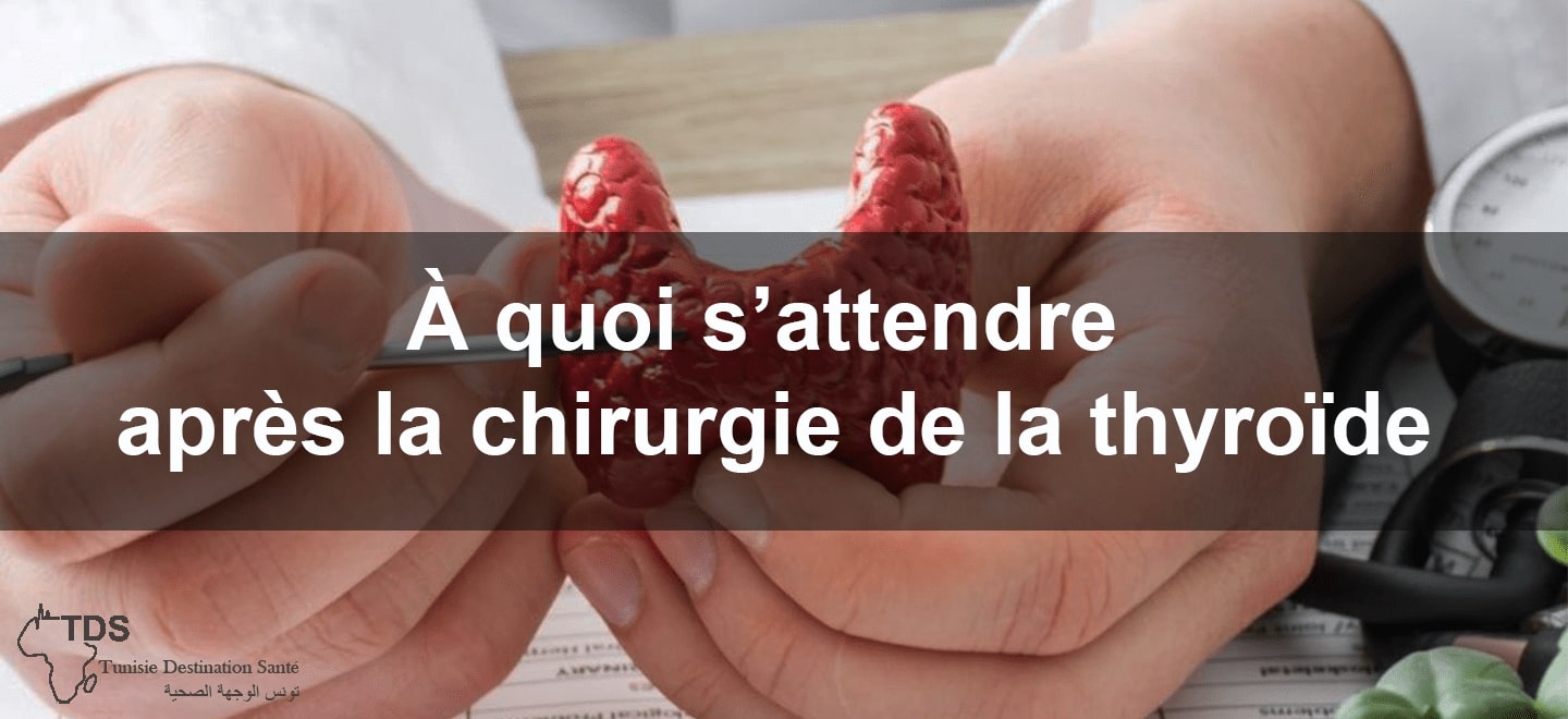 Après une chirurgie de la thyroïde : à quoi s'attendre ?