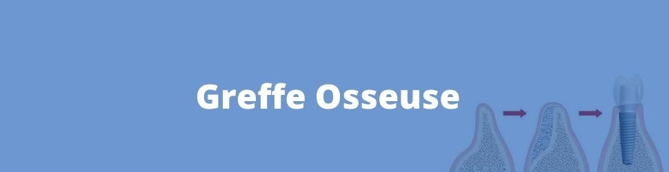 greffe ossesuse en tunisie