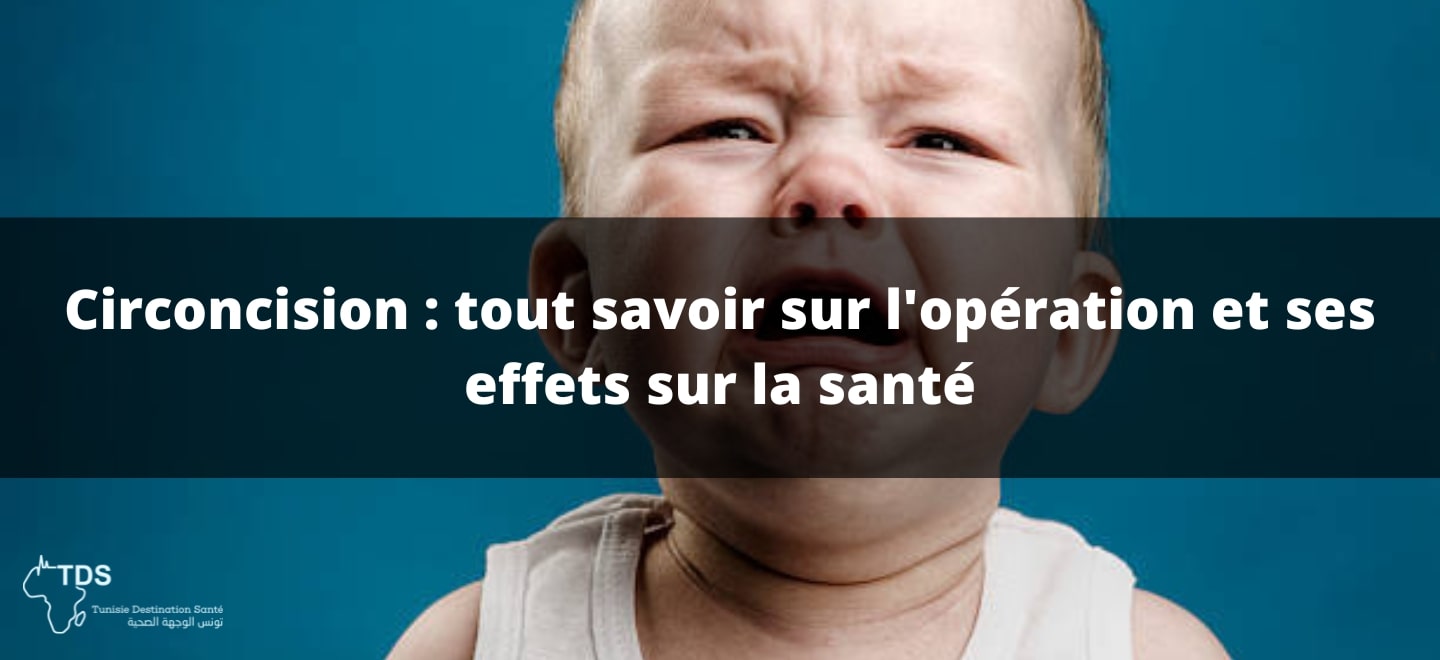 Circoncision tout savoir sur l'opération et ses effets sur la santé