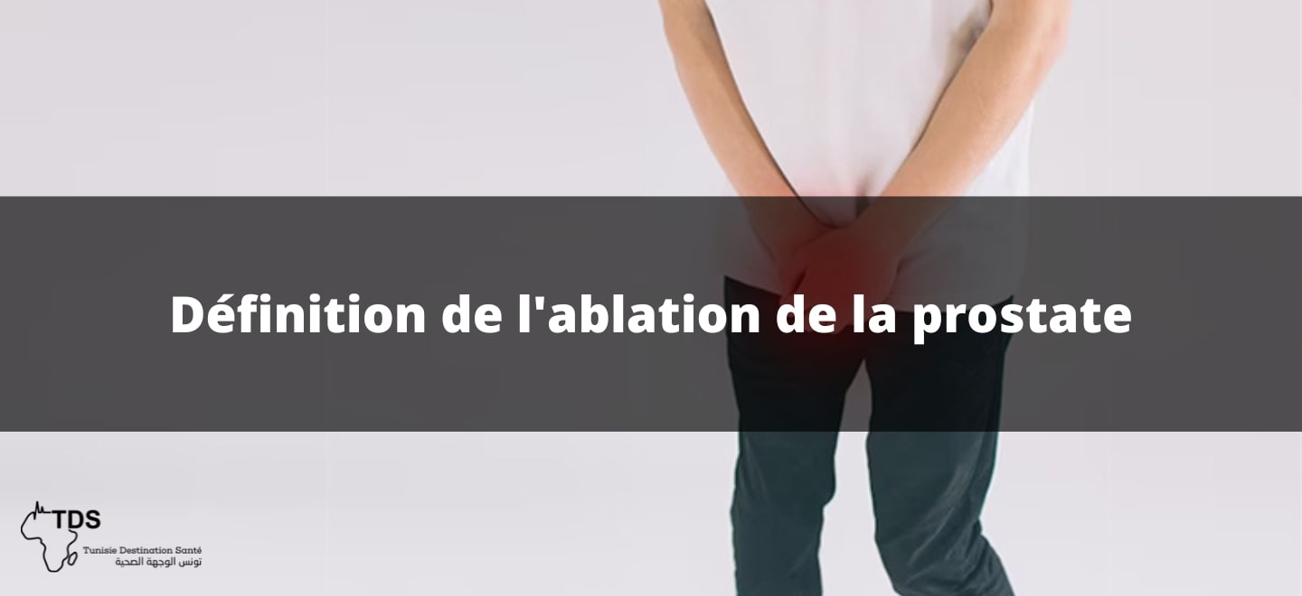 Définition de l'ablation de la prostate