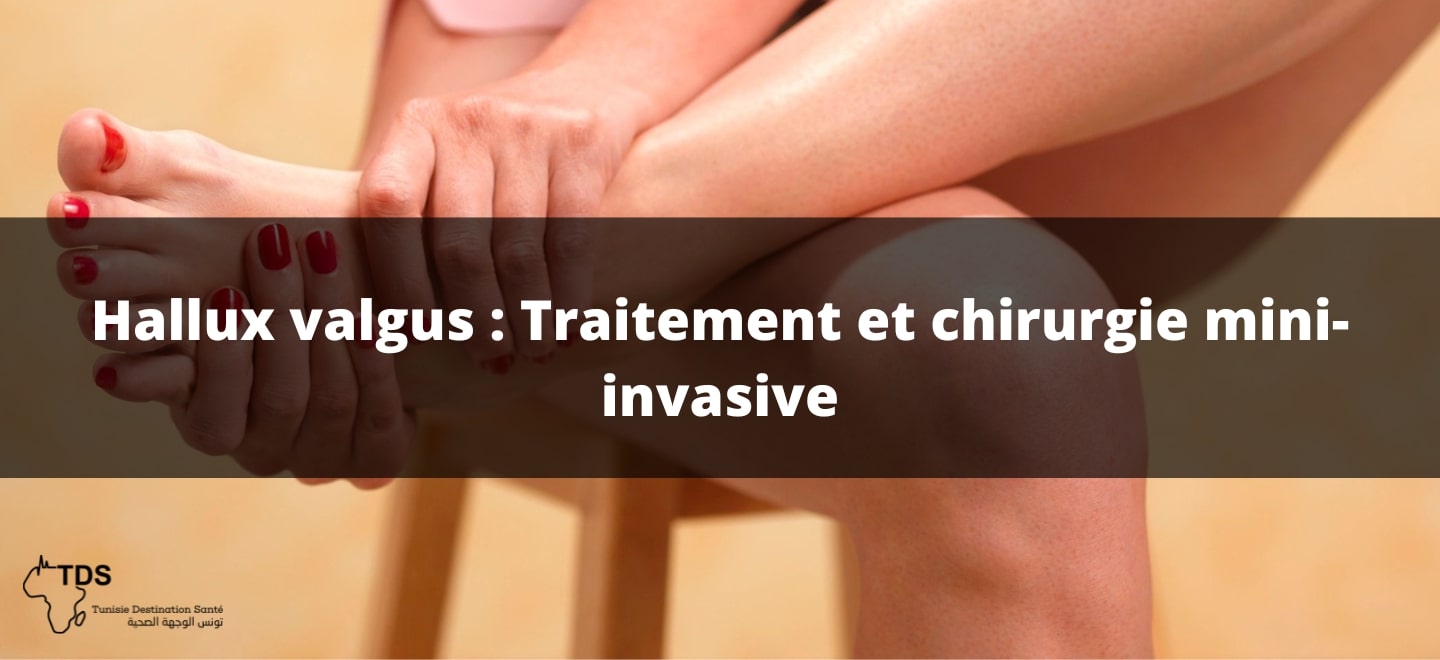 Hallux-valgus ,Traitement et chirurgie mini invasive