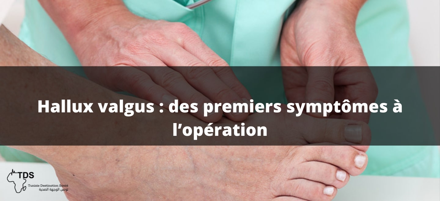 Hallux valgus , des premiers symptômes à l’opération