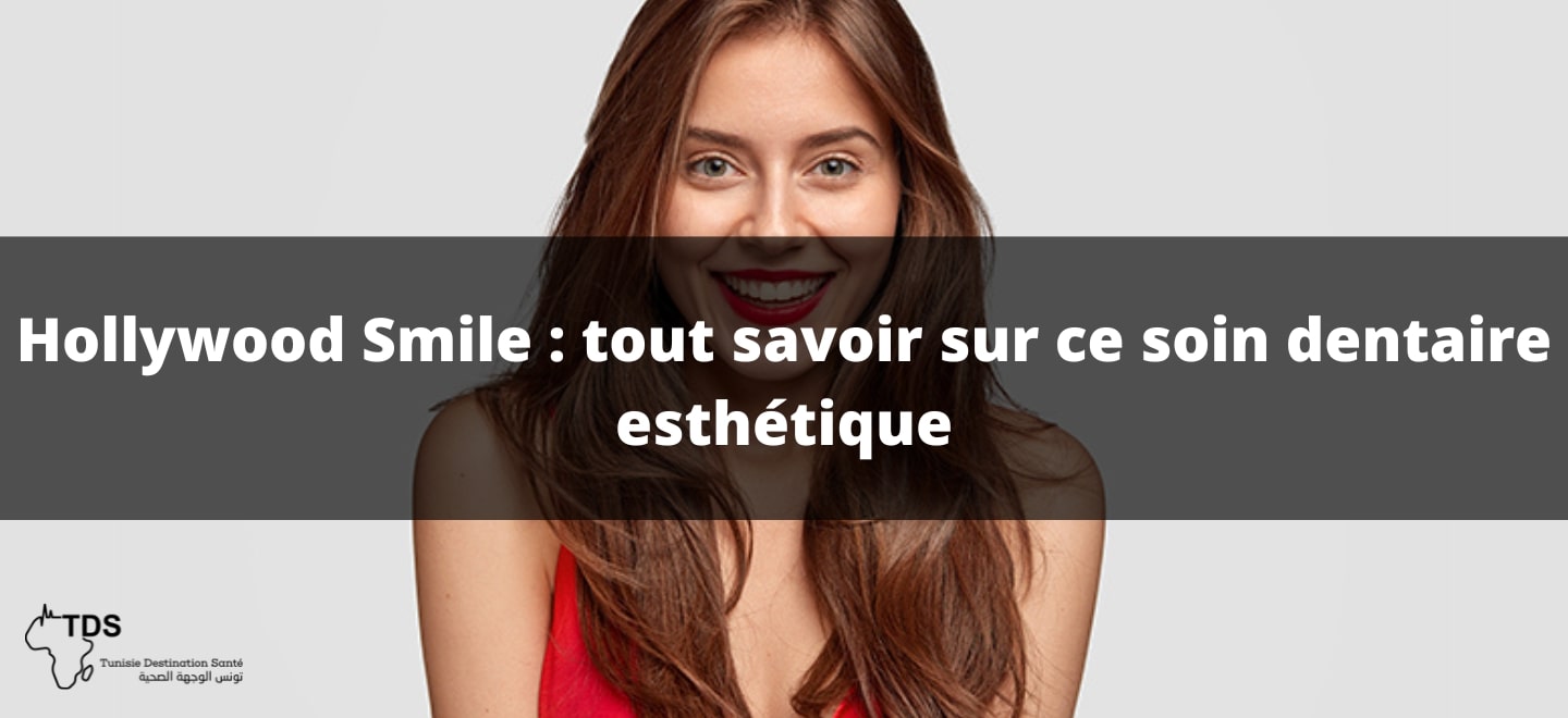 Hollywood Smile , tout savoir sur ce soin dentaire esthétique