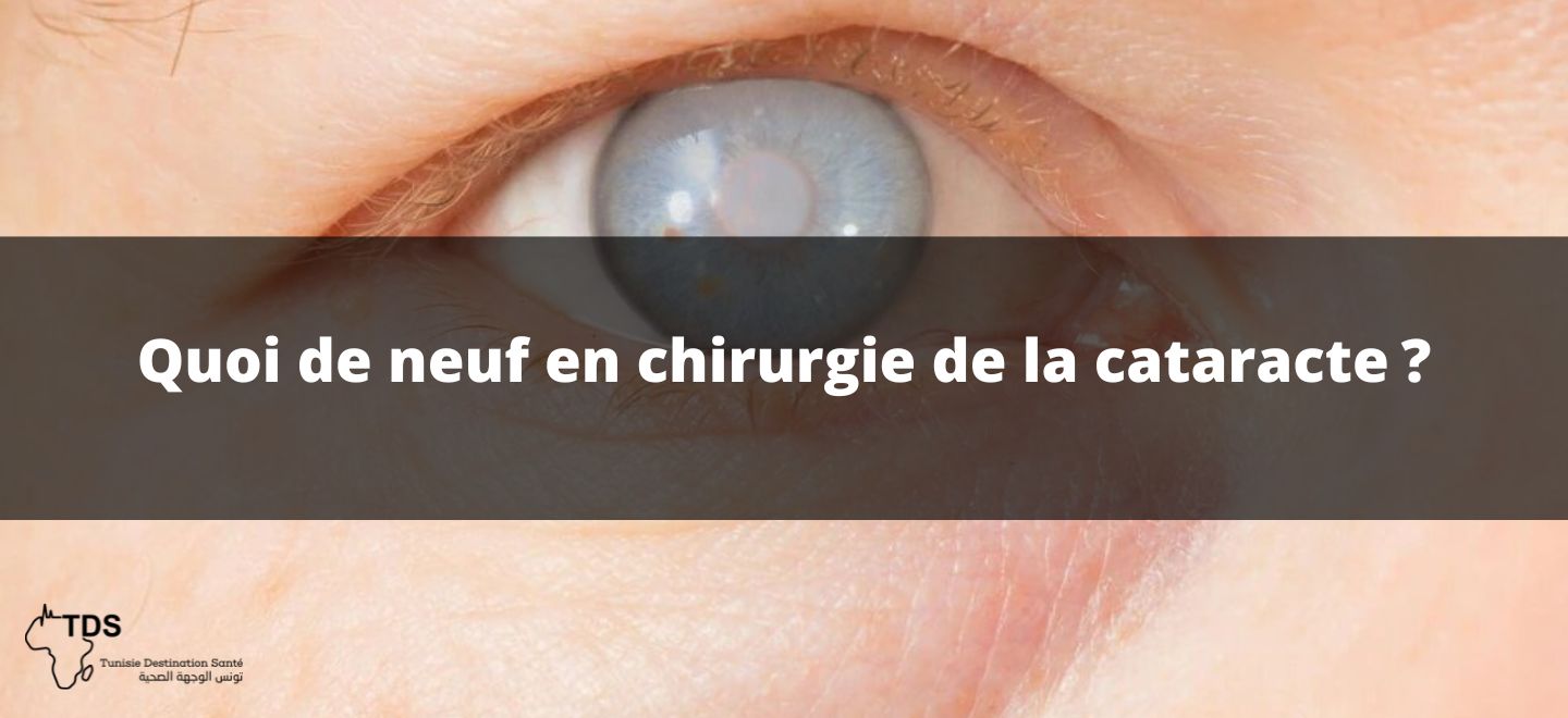 Quoi de neuf en chirurgie de la cataracte