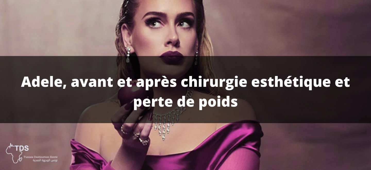 Adele , avant et après chirurgie esthétique et-perte de poids