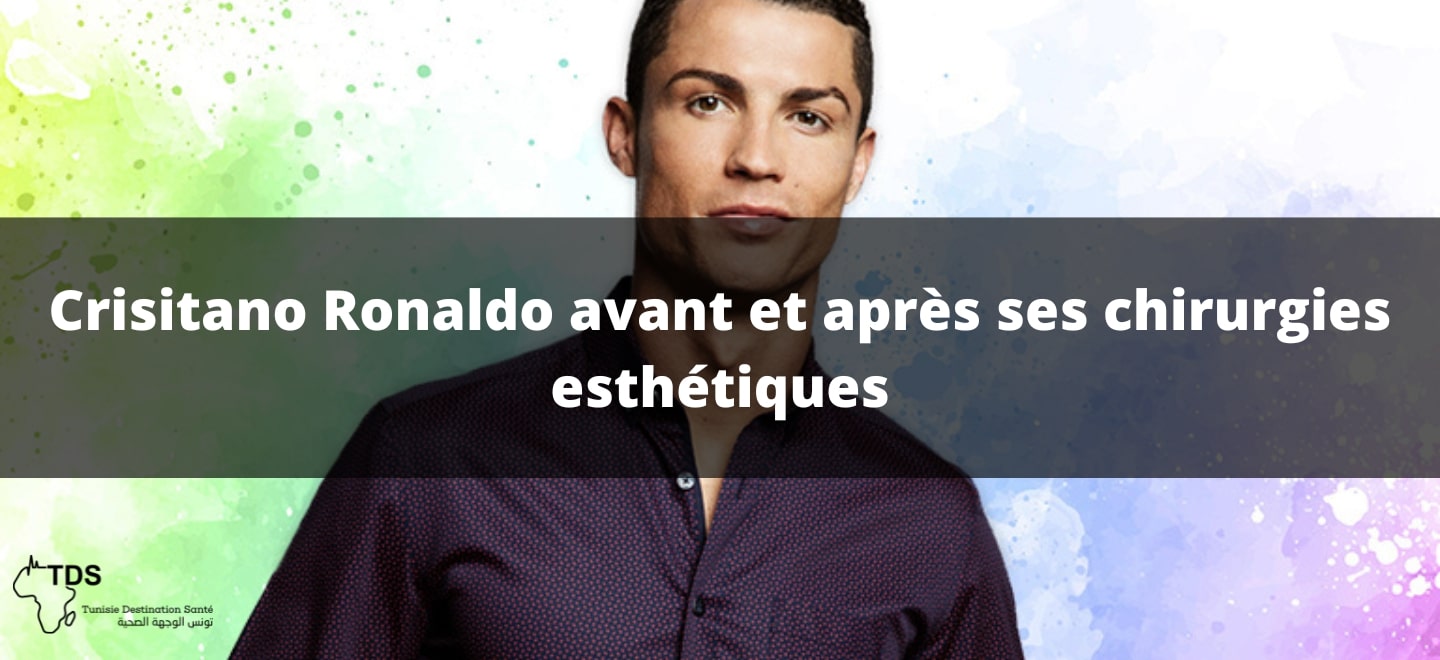 Crisitano Ronaldo avant et après ses chirurgies esthétiques