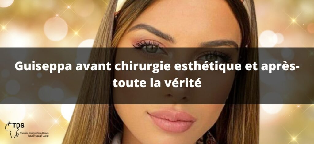 Giuseppa Rdm Giuseppa chirurgie esthétique , Elle surprennent les fans