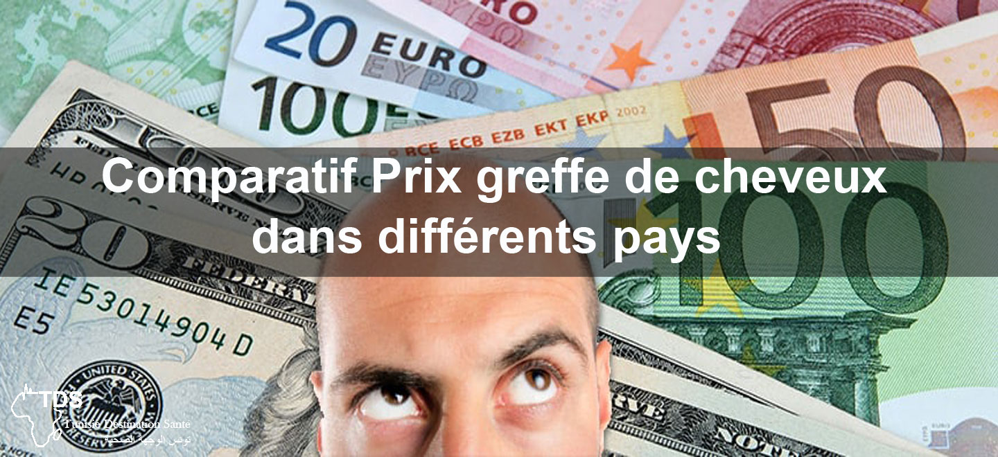 Comparatif de prix greffe de cheveux