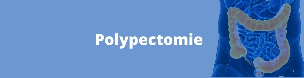 Polypectomie