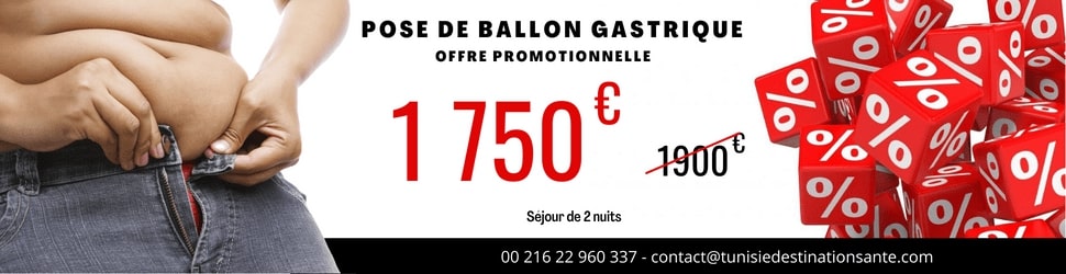 ballon gastrique