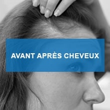 avant apres cheveux