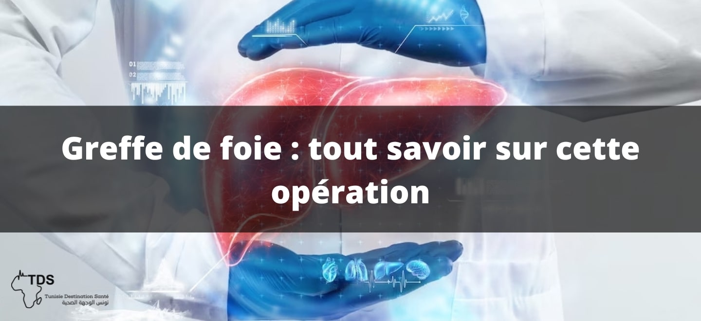 Greffe de foie : tout savoir sur cette opération