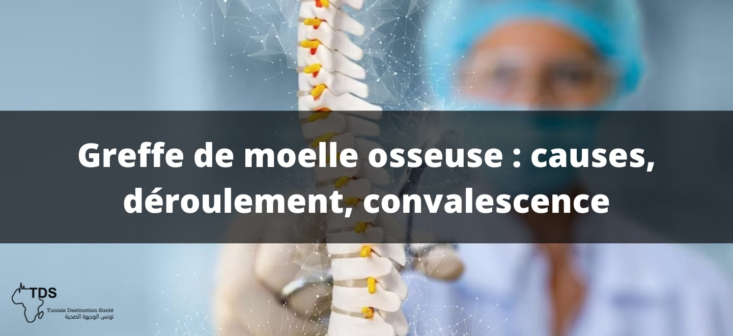 Greffe de moelle osseuse : causes, déroulement, convalescence