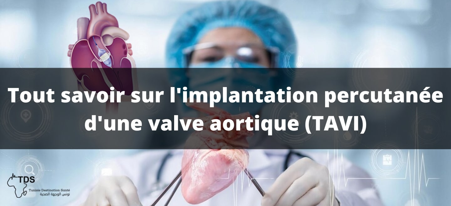 Tout savoir sur l'implantation percutanée d'une valve aortique (TAVI)