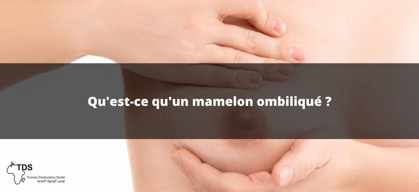 Mamelon ombiliqué