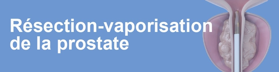 vaporisation de la prostate