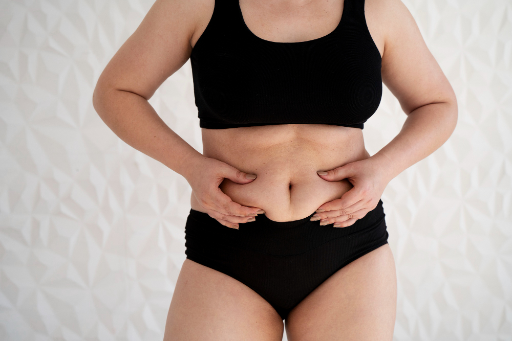 abdominoplastie pour femme