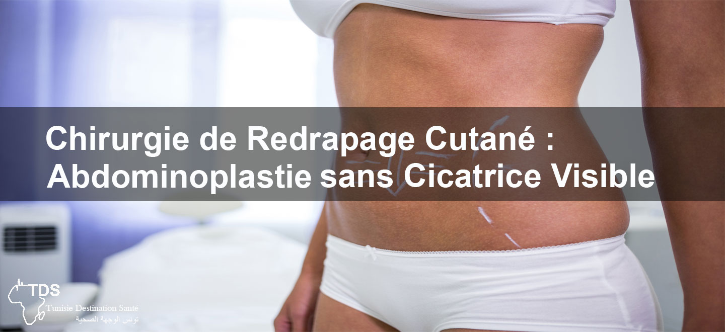 abdominoplastie sans cicatrice