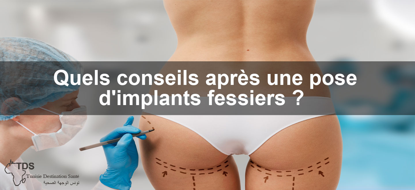 conseils après une pose implants fesseirs