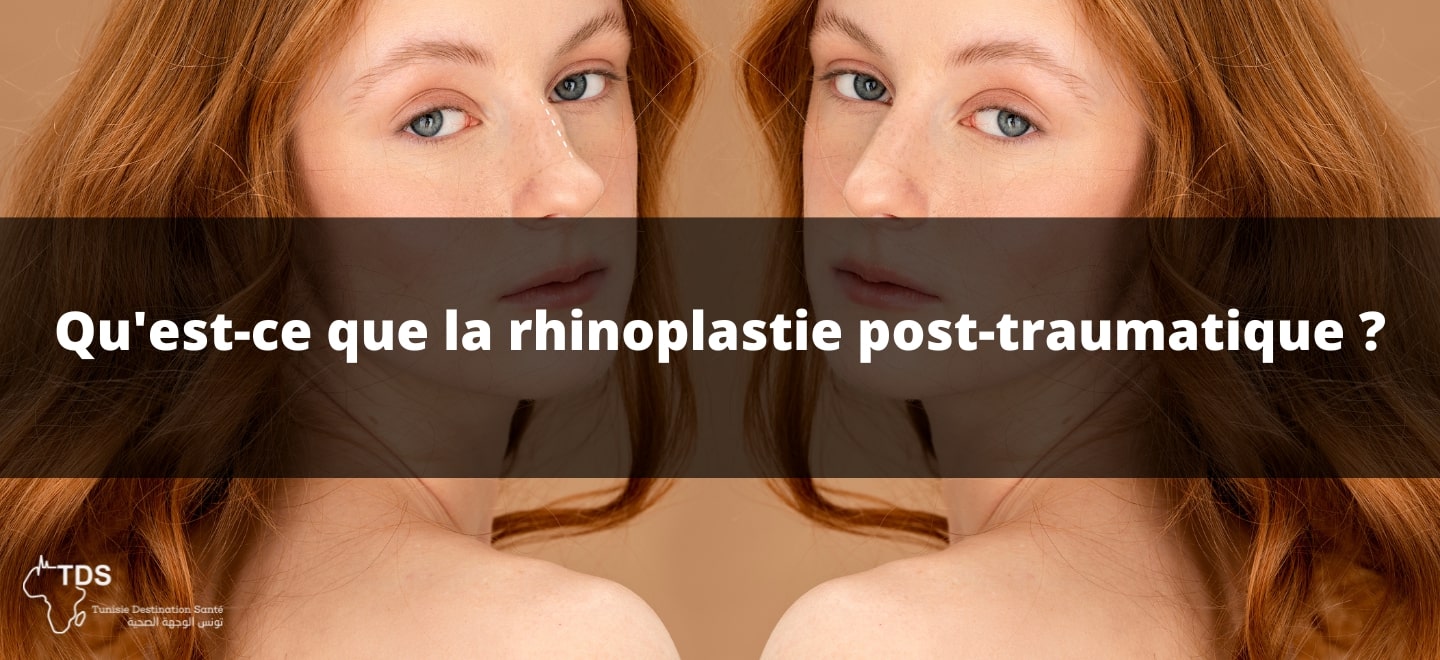 la Rhinoplastie post-traumatique