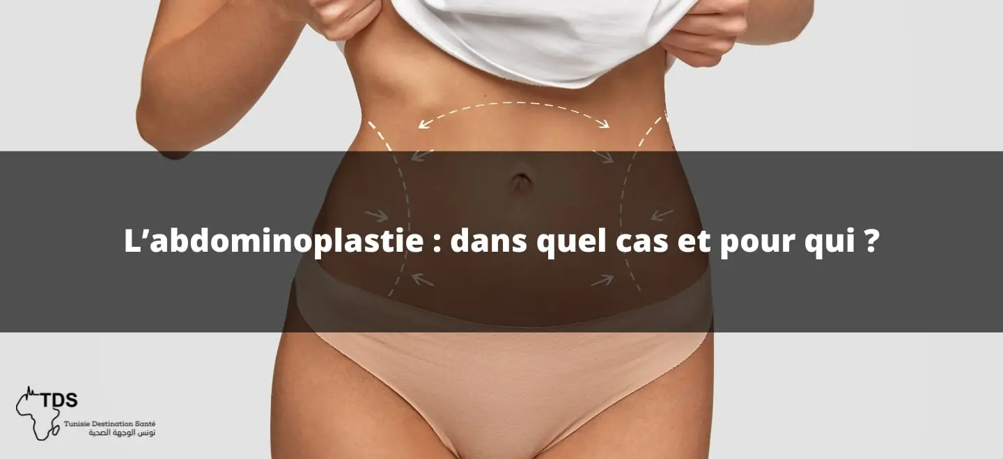 L'abdominoplastie