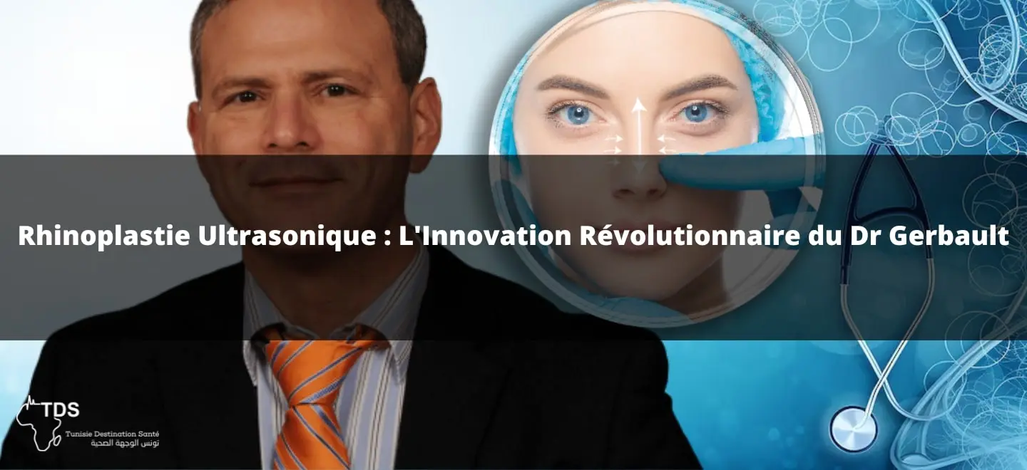 Rhinoplastie