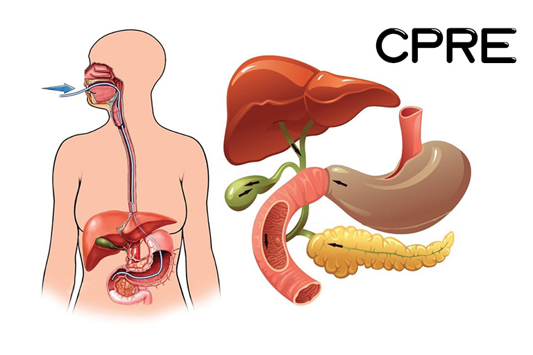 CPRE