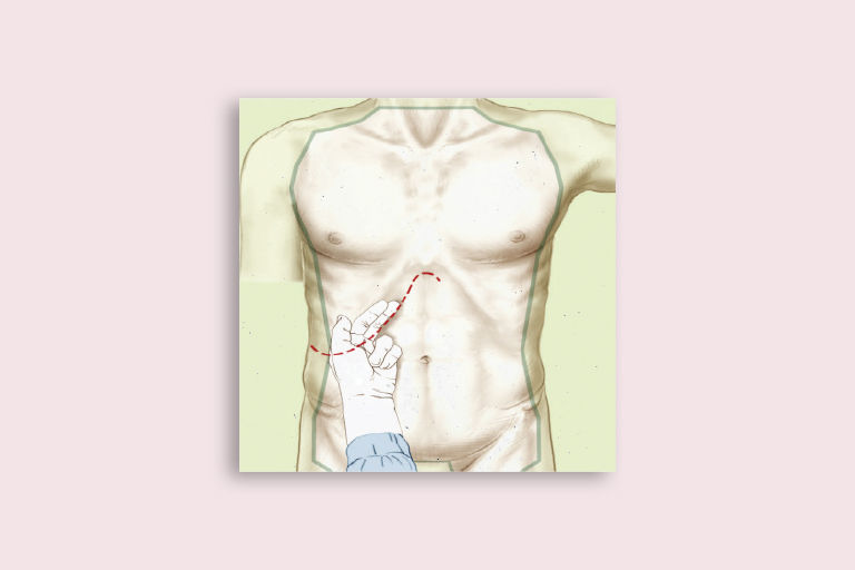 chirurgie hépatobiliaire