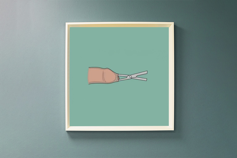 Circoncision