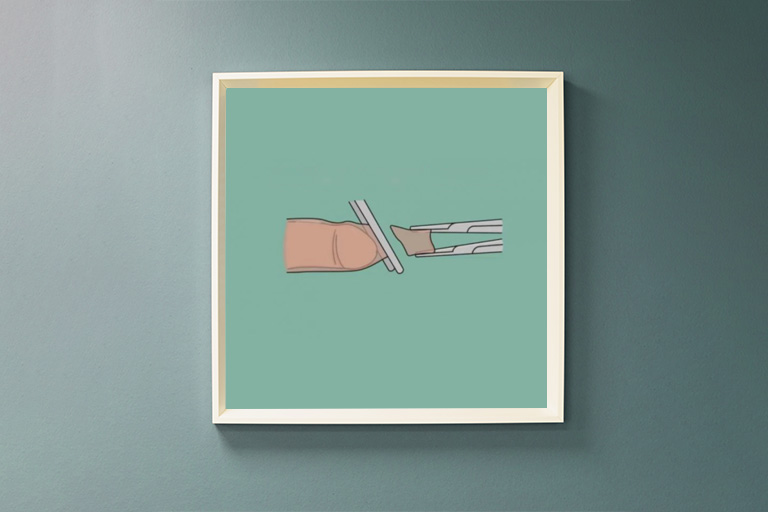Circoncision