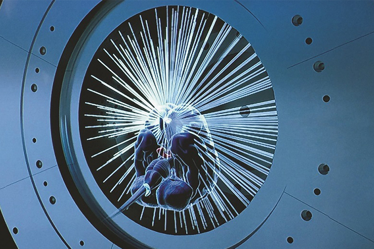 Gamma knife