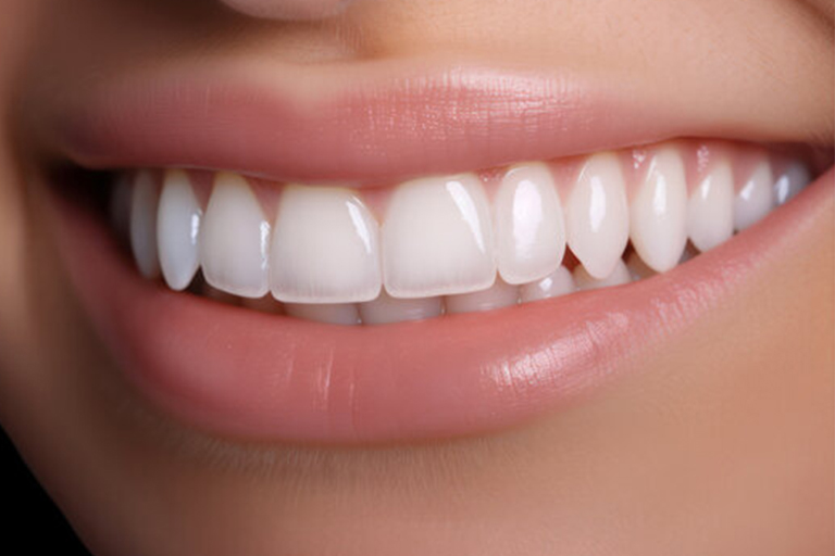 Hollywood Smile
