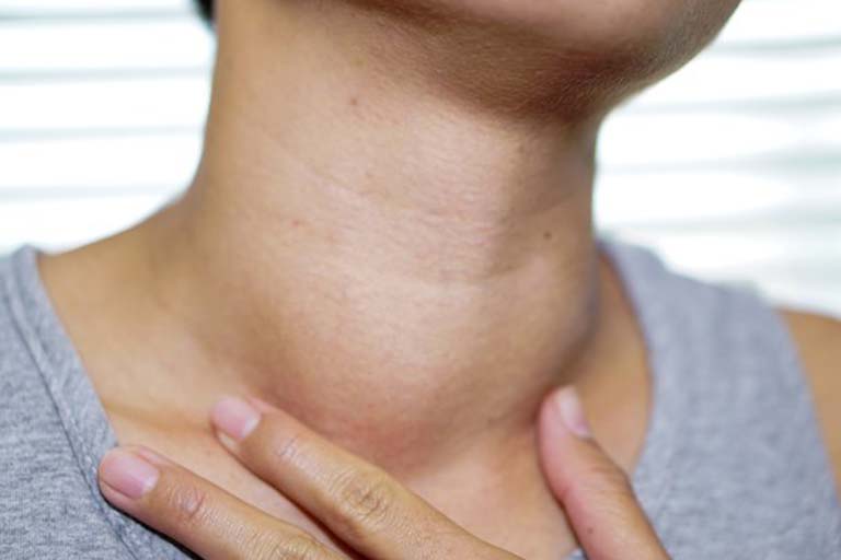 chirurgie de la thyroide