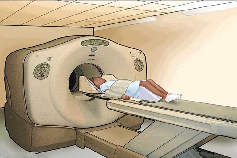PET scan