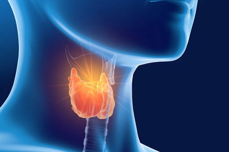 chirurgie de la thyroide