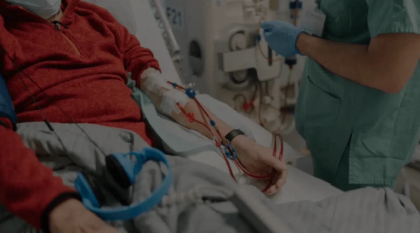 Fistule artério veineuse pour hémodialyse